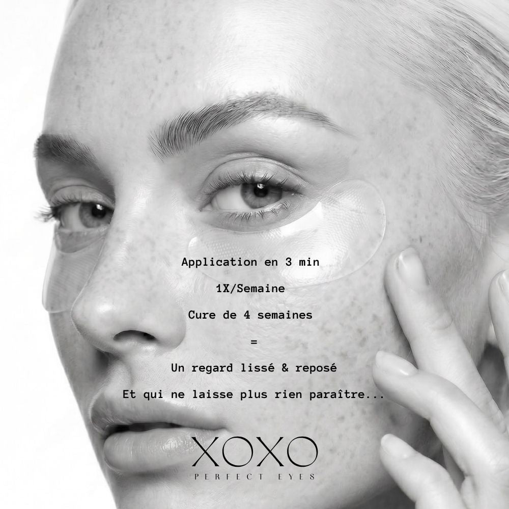 XOXO Perfect Eyes : Patchs yeux microneedle à l'acide hyaluronique et au collagène