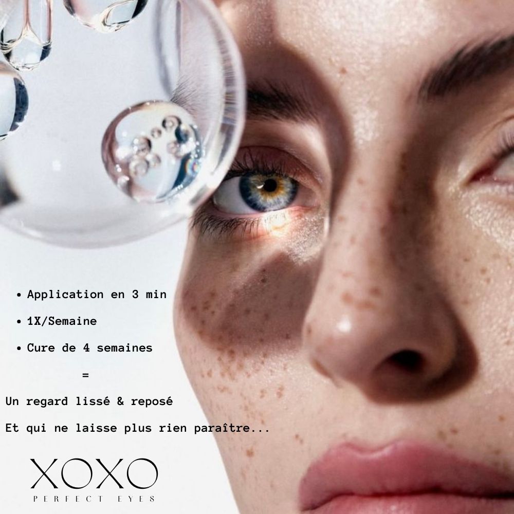 Patch Microneedle Acide Hyaluronique & Collagène – Soin Lissant Ridules et Cernes