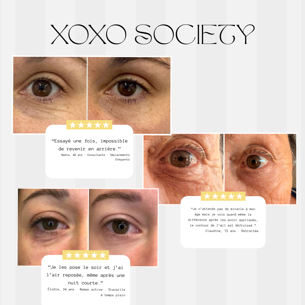XOXO Perfect Eyes : Patchs yeux microneedle à l'acide hyaluronique et au collagène