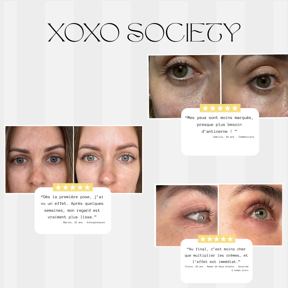 XOXO Perfect Eyes : Patchs yeux microneedle à l'acide hyaluronique et au collagène